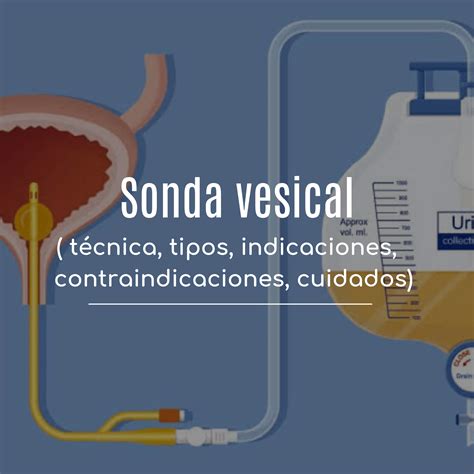 sonda vesical mujer real|Colocación de Sonda Vesical en Paciente Femenina